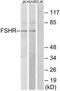 Follicle Stimulating Hormone Receptor antibody, TA313898, Origene, Western Blot image 