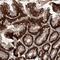 Stromal membrane-associated protein 1 antibody, PA5-56509, Invitrogen Antibodies, Immunohistochemistry paraffin image 