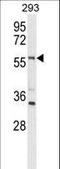 Limb Development Membrane Protein 1 Like antibody, LS-C165807, Lifespan Biosciences, Western Blot image 