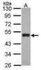 Peripherin antibody, TA308940, Origene, Western Blot image 