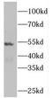 Pleckstrin Homology Domain Containing O2 antibody, FNab06544, FineTest, Western Blot image 