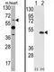 ETS Variant 4 antibody, AP17352PU-N, Origene, Western Blot image 