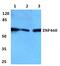 Zinc Finger Protein 460 antibody, PA5-37083, Invitrogen Antibodies, Western Blot image 