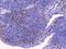 B And T Lymphocyte Associated antibody, A03149, Boster Biological Technology, Immunohistochemistry paraffin image 