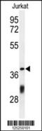 Coiled-Coil Domain Containing 130 antibody, 61-643, ProSci, Western Blot image 