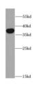 Dickkopf WNT Signaling Pathway Inhibitor 3 antibody, FNab02403, FineTest, Western Blot image 