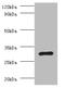 Ribosomal Protein L5 antibody, A51577-100, Epigentek, Western Blot image 