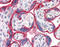 EGFR antibody, 51-852, ProSci, Immunohistochemistry paraffin image 