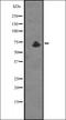 Zinc Finger DHHC-Type Containing 17 antibody, orb335411, Biorbyt, Western Blot image 