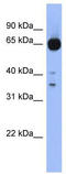 Zic Family Member 4 antibody, TA345435, Origene, Western Blot image 