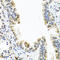 Calcitonin Related Polypeptide Beta antibody, 23-403, ProSci, Immunohistochemistry frozen image 