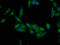 Glutamyl-Prolyl-TRNA Synthetase antibody, CSB-PA007747LA01HU, Cusabio, Immunofluorescence image 