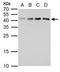Melatonin receptor type 1B antibody, GTX129715, GeneTex, Western Blot image 