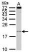 Eukaryotic Translation Initiation Factor 1A Y-Linked antibody, PA5-31198, Invitrogen Antibodies, Western Blot image 
