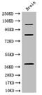 PDZ Domain Containing Ring Finger 3 antibody, OACA09962, Aviva Systems Biology, Western Blot image 