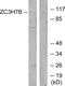 Zinc Finger CCCH-Type Containing 7B antibody, GTX87217, GeneTex, Western Blot image 