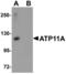 ATPase Phospholipid Transporting 11A antibody, LS-B5310, Lifespan Biosciences, Western Blot image 