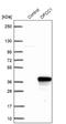 Orofacial Cleft 1 Candidate 1 antibody, NBP2-47348, Novus Biologicals, Western Blot image 