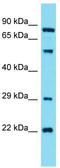 Guanylate Cyclase 1 Soluble Subunit Alpha 2 antibody, TA337335, Origene, Western Blot image 