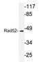 DNA repair protein RAD52 homolog antibody, AP20268PU-N, Origene, Western Blot image 