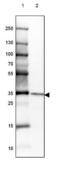 Charged multivesicular body protein 5 antibody, NBP2-49227, Novus Biologicals, Western Blot image 