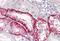 Cathepsin K antibody, MBS246441, MyBioSource, Immunohistochemistry paraffin image 