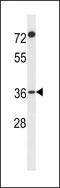 Protein FAM110A antibody, LS-C157734, Lifespan Biosciences, Western Blot image 