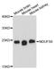 NADH dehydrogenase [ubiquinone] iron-sulfur protein 8, mitochondrial antibody, A13034, ABclonal Technology, Western Blot image 