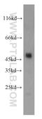 Carboxypeptidase B1 antibody, 12600-1-AP, Proteintech Group, Western Blot image 