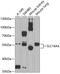 Monocarboxylate transporter 5 antibody, GTX54681, GeneTex, Western Blot image 