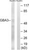Cytosolic beta-glucosidase antibody, LS-C119890, Lifespan Biosciences, Western Blot image 