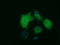 Histone deacetylase 10 antibody, TA500755, Origene, Immunofluorescence image 