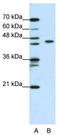 Zinc Finger And BTB Domain Containing 9 antibody, TA345562, Origene, Western Blot image 