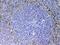 Endoglin antibody, A02997-2, Boster Biological Technology, Immunohistochemistry paraffin image 