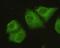 Protein Phosphatase 2 Catalytic Subunit Alpha antibody, M01893, Boster Biological Technology, Immunofluorescence image 