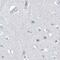 Chymotrypsin Like antibody, PA5-56959, Invitrogen Antibodies, Immunohistochemistry frozen image 