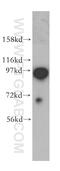 Coatomer Protein Complex Subunit Gamma 1 antibody, 12393-1-AP, Proteintech Group, Western Blot image 
