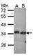 Peroxisomal Trans-2-Enoyl-CoA Reductase antibody, orb69804, Biorbyt, Western Blot image 