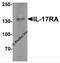 Interleukin-17 receptor A antibody, 7419, ProSci Inc, Western Blot image 