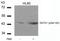 GATA Binding Protein 1 antibody, GTX50116, GeneTex, Western Blot image 