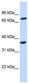 C-C Motif Chemokine Receptor Like 2 antibody, TA334723, Origene, Western Blot image 