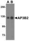 Adaptor Related Protein Complex 3 Subunit Beta 2 antibody, NBP1-76590, Novus Biologicals, Western Blot image 