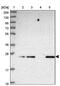 Chromosome 19 Open Reading Frame 71 antibody, PA5-61796, Invitrogen Antibodies, Western Blot image 
