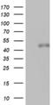 Spermatogenesis Associated 2 Like antibody, NBP2-45940, Novus Biologicals, Western Blot image 