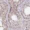 DEAD-Box Helicase 55 antibody, NBP2-47490, Novus Biologicals, Immunohistochemistry paraffin image 