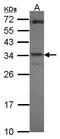 ICER antibody, PA5-29927, Invitrogen Antibodies, Western Blot image 