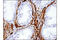 Ubiquitin C-Terminal Hydrolase L1 antibody, 13179S, Cell Signaling Technology, Immunohistochemistry paraffin image 
