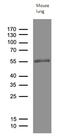 MOK Protein Kinase antibody, M01004, Boster Biological Technology, Western Blot image 