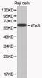WAS antibody, PA5-37303, Invitrogen Antibodies, Western Blot image 
