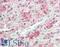 Vascular Cell Adhesion Molecule 1 antibody, LS-B11197, Lifespan Biosciences, Immunohistochemistry frozen image 
